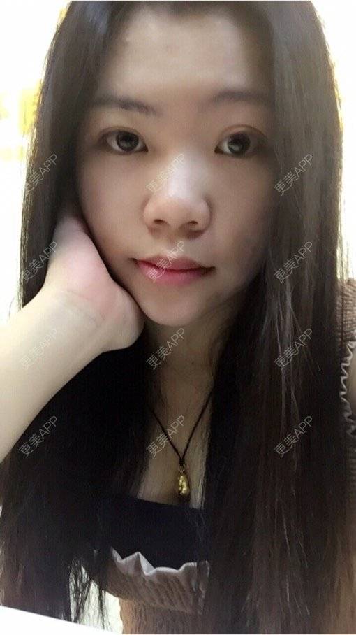 更美 - 孤单魔女-妮的经验 | 鼻基底 | 丰胸（隆胸） | 洗牙套餐 | 双眼皮 | 上海 | 鼻部综合 | 武汉 | 长沙 | 广州 | 牙齿矫正 | 深圳 | 吸脂 | 拉皮 | 南宁 | 小气泡 | 宁波 | 硅胶隆鼻 | 北京 | 南京 | 玻尿酸 | 除皱瘦脸 | 冷光美白