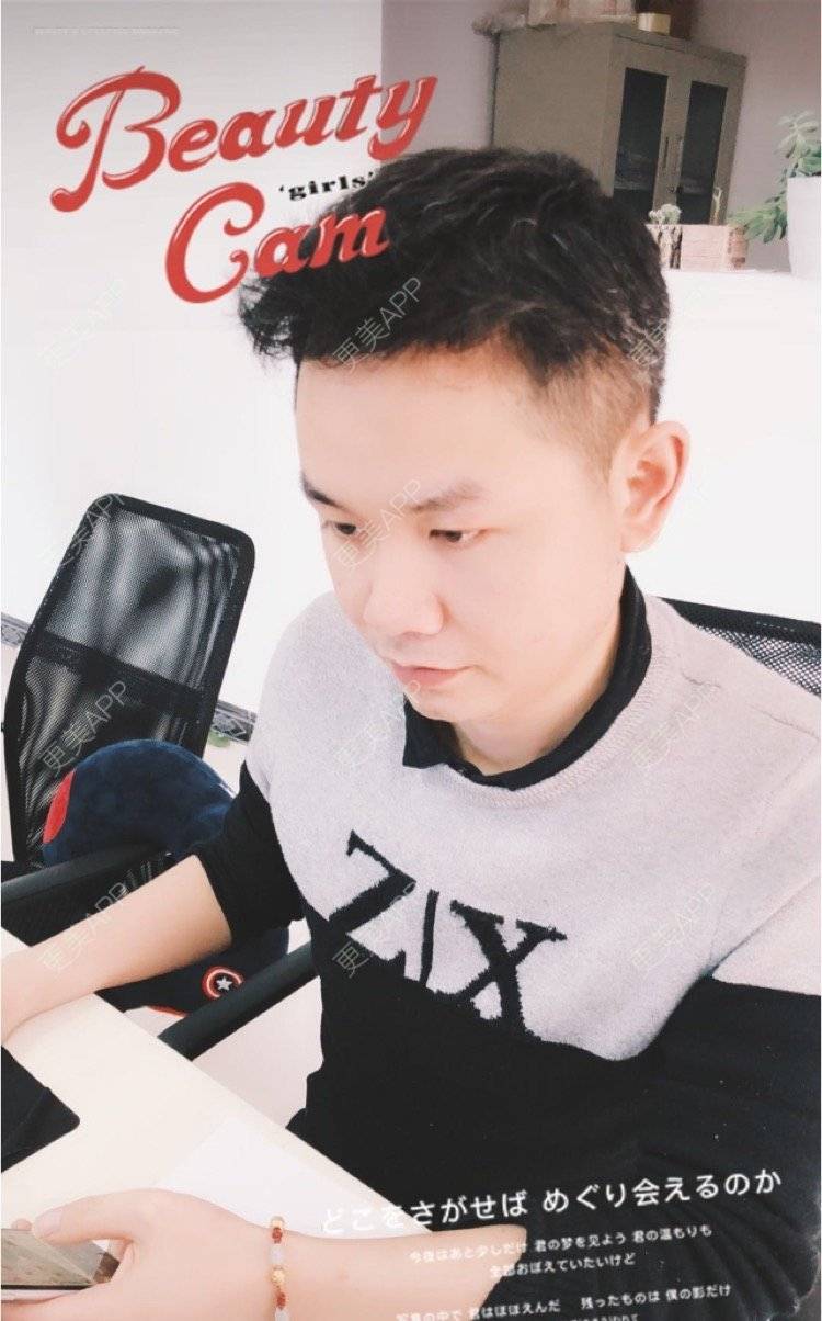 更美 - 小小祥子的M唇成形经验 | M唇成形 | 视频日记 | 重庆 | 厚唇改薄 | 唇综合