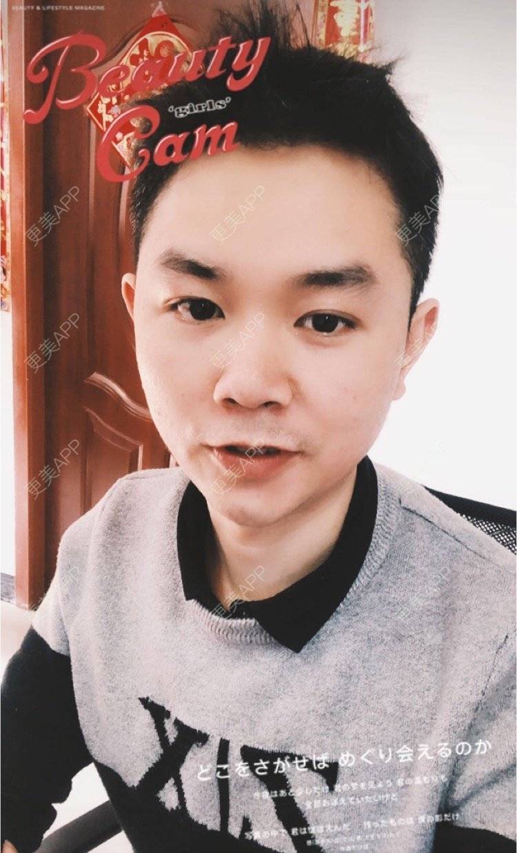 更美 - 小小祥子的M唇成形经验 | M唇成形 | 视频日记 | 重庆 | 厚唇改薄 | 唇综合