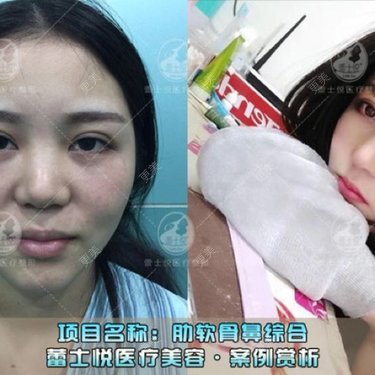李海兵 医生