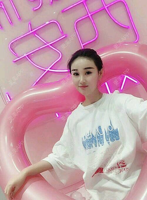 美琳娜的定点双眼皮日记