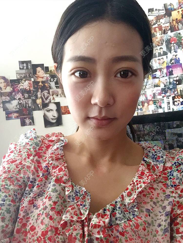 更美 - 涂飞翔 医生的眼部综合经验 | 眼部综合 | 南昌