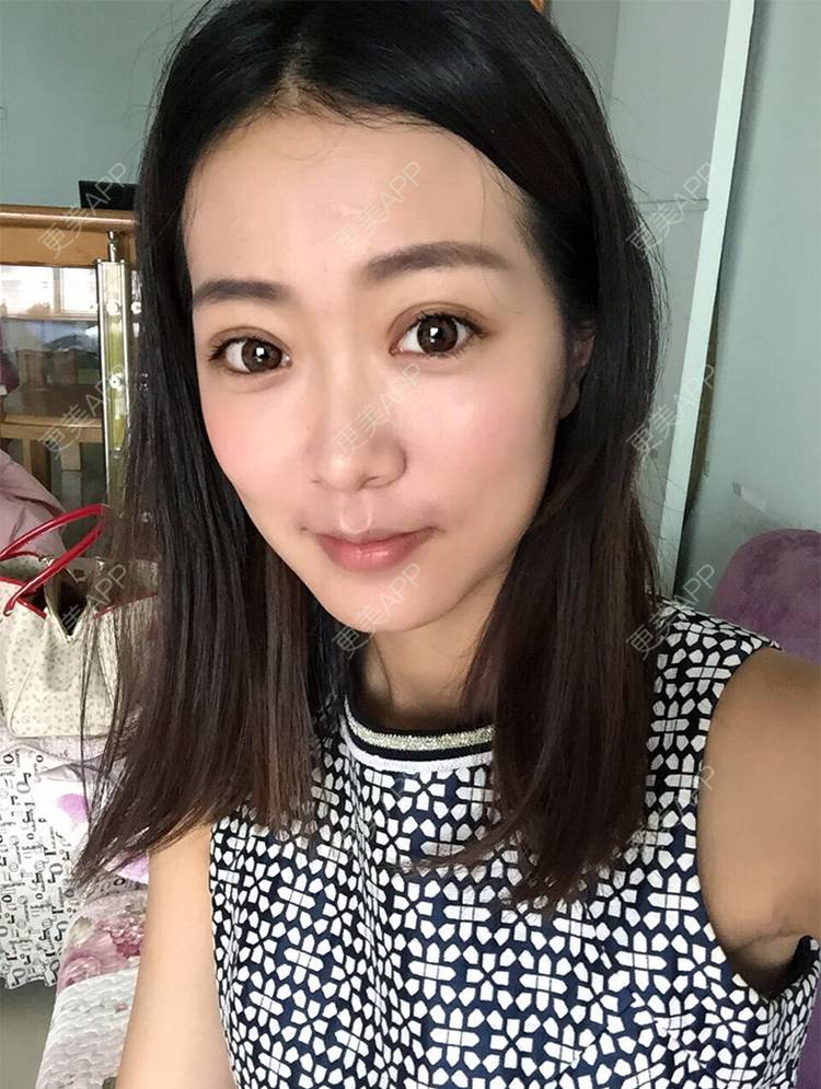 更美 - 涂飞翔 医生的眼部综合经验 | 南昌 | 眼部综合