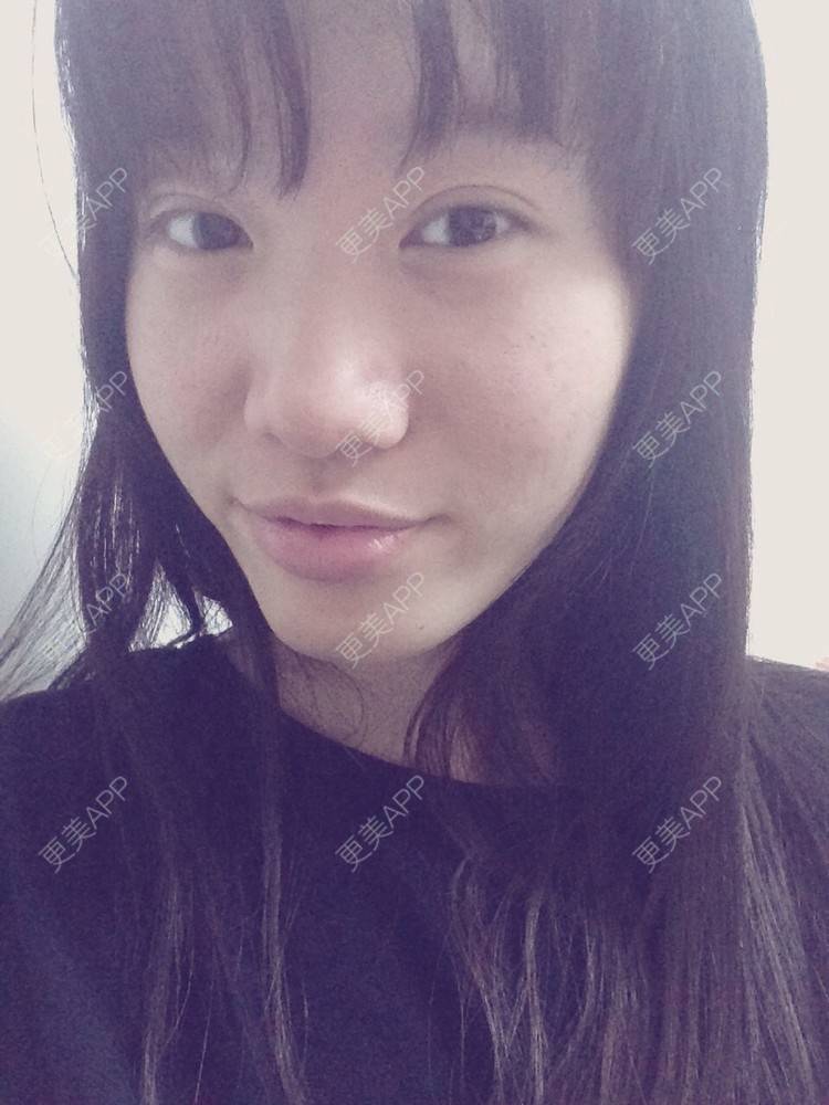 隔壁老王是哈麻批的双眼皮日记