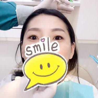 冷光美白