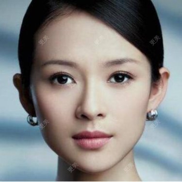 自体脂肪丰太阳穴