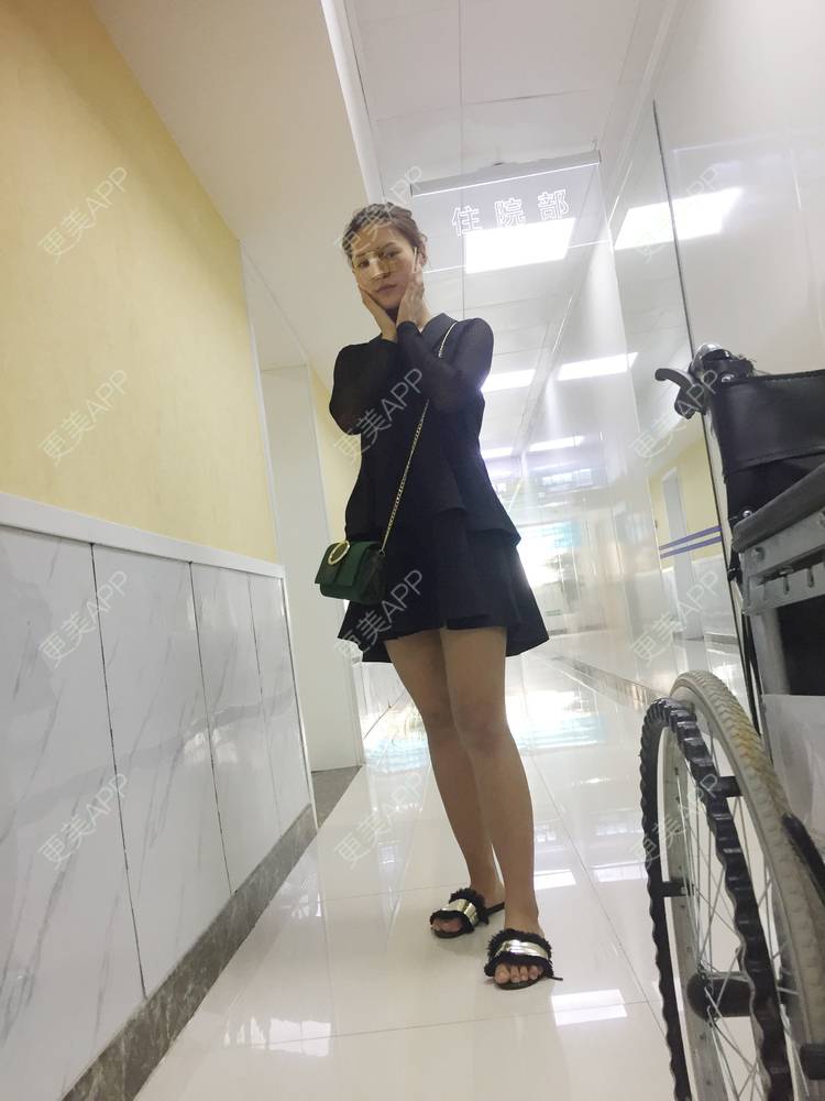 更美 - 姚小女子的耳软骨隆鼻经验 | 耳软骨隆鼻 | 成都