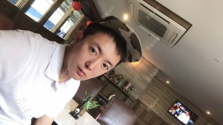 更美 - 厦门欧菲医疗美容医院的埋线提升经验 | 厦门 | 埋线提升
