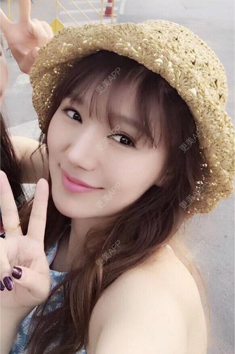 更美 - 更美用户Bi9obEIP28的膨体隆鼻经验 | 北京 | 水光项目 | 双眼皮 | 福州 | 武汉 | 长沙 | 广州 | 半永久纹眉 | 深圳 | 吸脂 | 南宁 | 成都 | 祛斑祛色素 | 水氧活肤 | 膨体隆鼻 | 埋线提升 | 瘦脸除皱 | 除皱瘦脸 | 冷冻溶脂 | 皮秒激光 | 玻尿酸 | 硅胶垫下巴