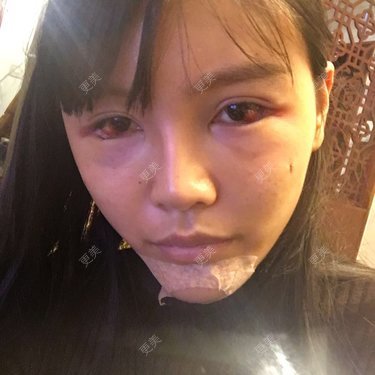 十点差三分的时候开始