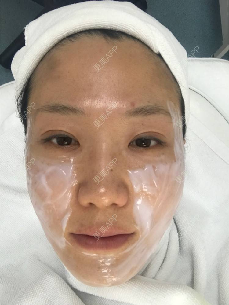 更美 - 舒怡的经验 | 自体脂肪隆胸 | 自体脂肪丰太阳穴 | 硅胶隆鼻 | 水光项目 | 牙齿矫正 | 双眼皮 | 上海 | 北京 | 除皱瘦脸 | 武汉 | 埋线提升 | 长沙 | 广州 | 牙贴面 | 深圳 | 南昌 | 南京 | 鼻部综合