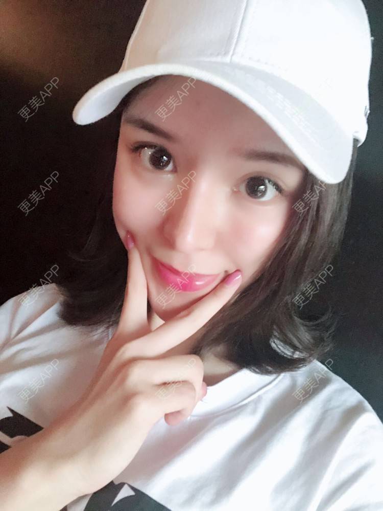 更美 - 罗莉 医生的鼻部多项经验 | 鼻翼 | 福州 | 隆鼻 | 鼻部多项
