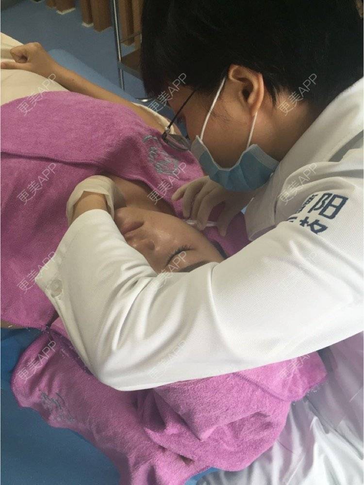 更美 - 超级飞侠1的玻尿酸颈纹经验 | 玻尿酸颈纹 | 重庆