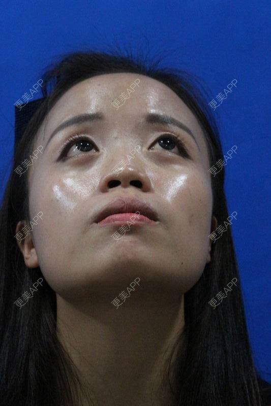 更美用户k7x61duzis的鼻综合日记