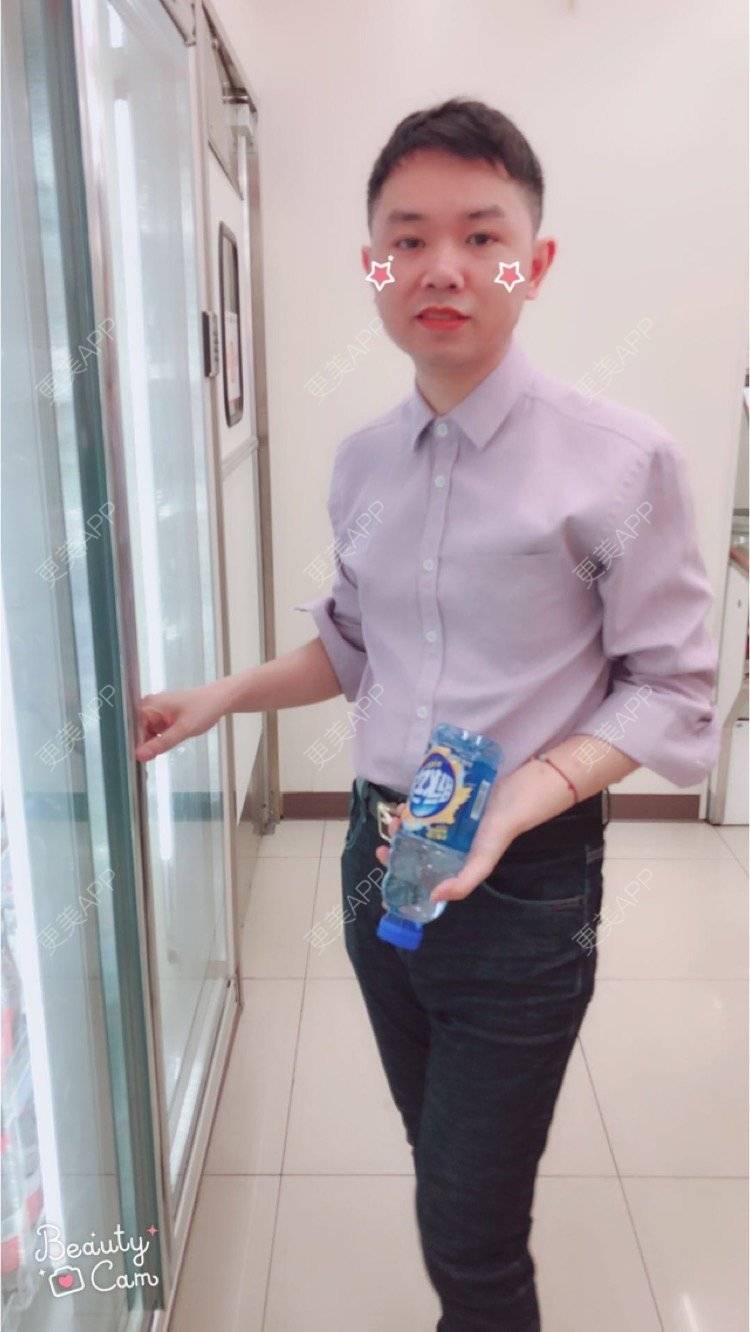 更美 - 小小祥子的M唇成形经验 | M唇成形 | 视频日记 | 重庆 | 厚唇改薄 | 唇综合