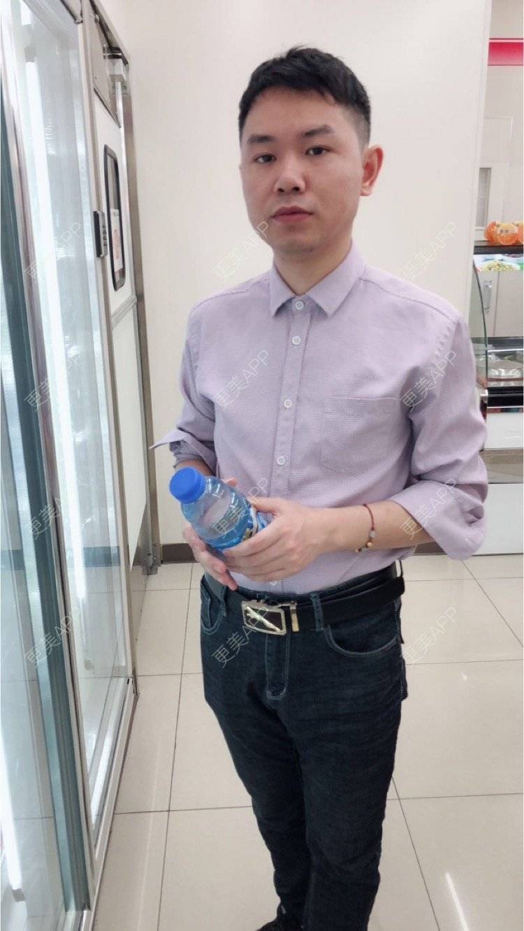 更美 - 小小祥子的M唇成形经验 | M唇成形 | 视频日记 | 重庆 | 厚唇改薄 | 唇综合