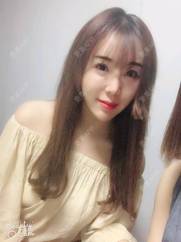 更美 - 打不过我吧的硅胶隆鼻经验 | 硅胶隆鼻 | 濮阳