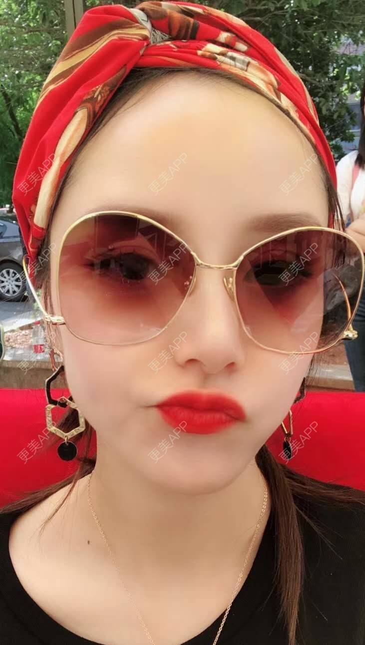 更美 - 请叫我灰姑娘GAO的果酸焕肤经验 | 视频日记 | 南宁 | 果酸焕肤