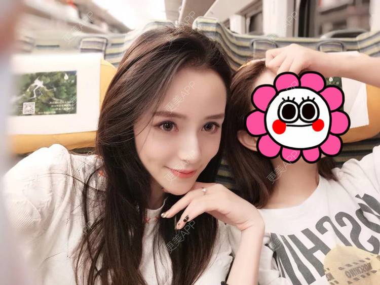 更美 - 请叫我灰姑娘GAO的果酸焕肤经验 | 视频日记 | 南宁 | 果酸焕肤