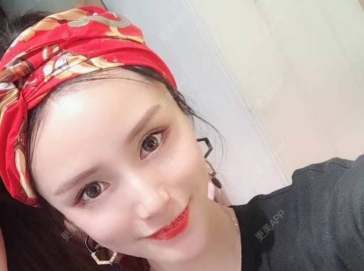 更美 - 请叫我灰姑娘GAO的果酸焕肤经验 | 视频日记 | 南宁 | 果酸焕肤