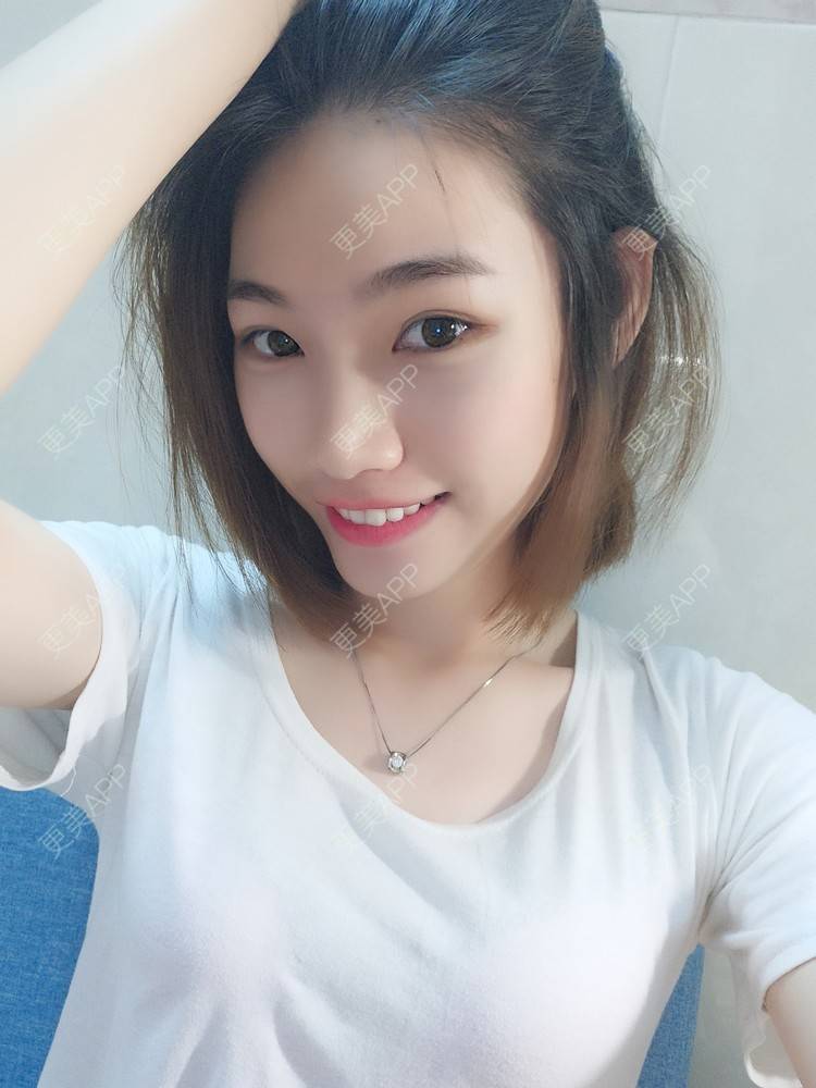 更美 - 李继华 医生的下颌角经验 | 视频日记 | 下颌角