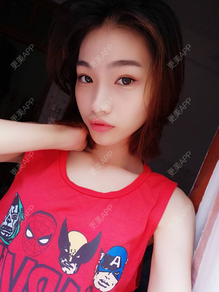 更美 - 李继华 医生的下颌角经验 | 视频日记 | 下颌角