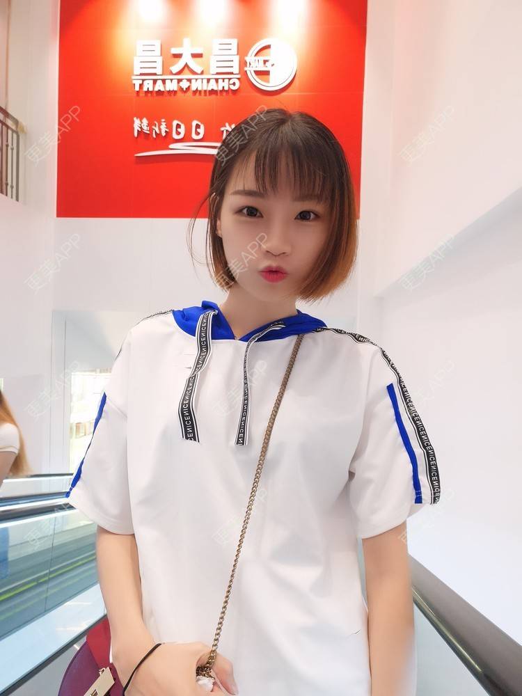更美 - 李继华 医生的下颌角经验 | 视频日记 | 下颌角