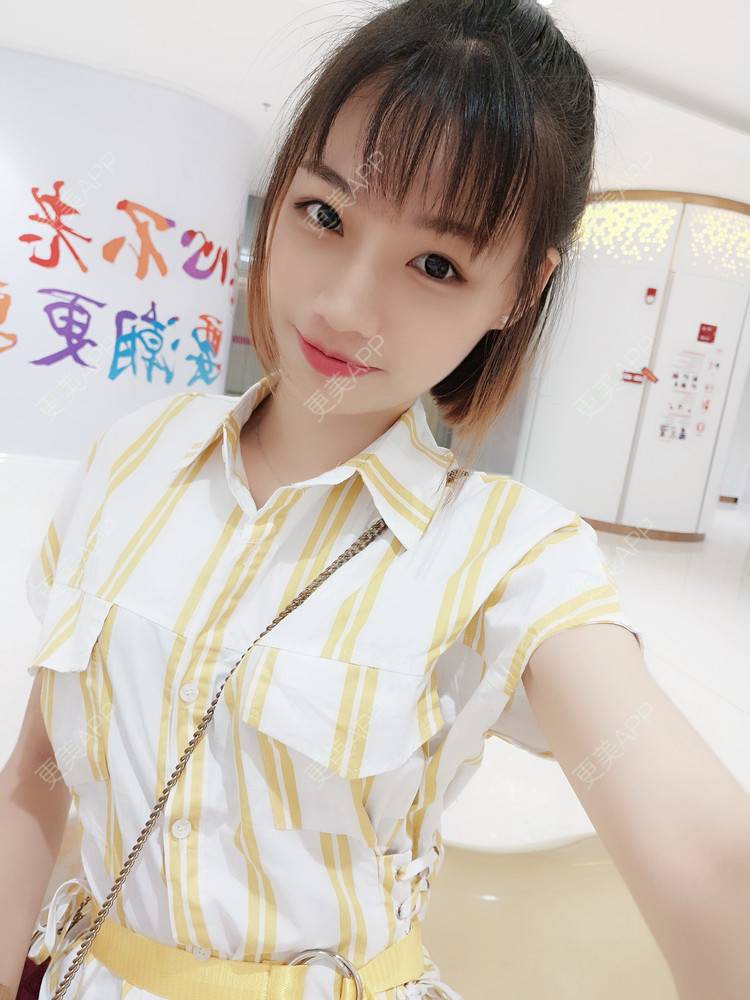 更美 - 李继华 医生的下颌角经验 | 视频日记 | 下颌角