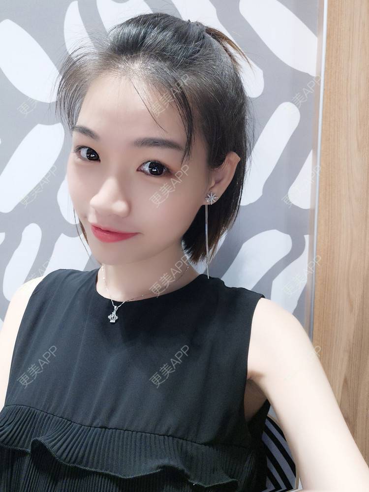 更美 - 李继华 医生的下颌角经验 | 视频日记 | 下颌角