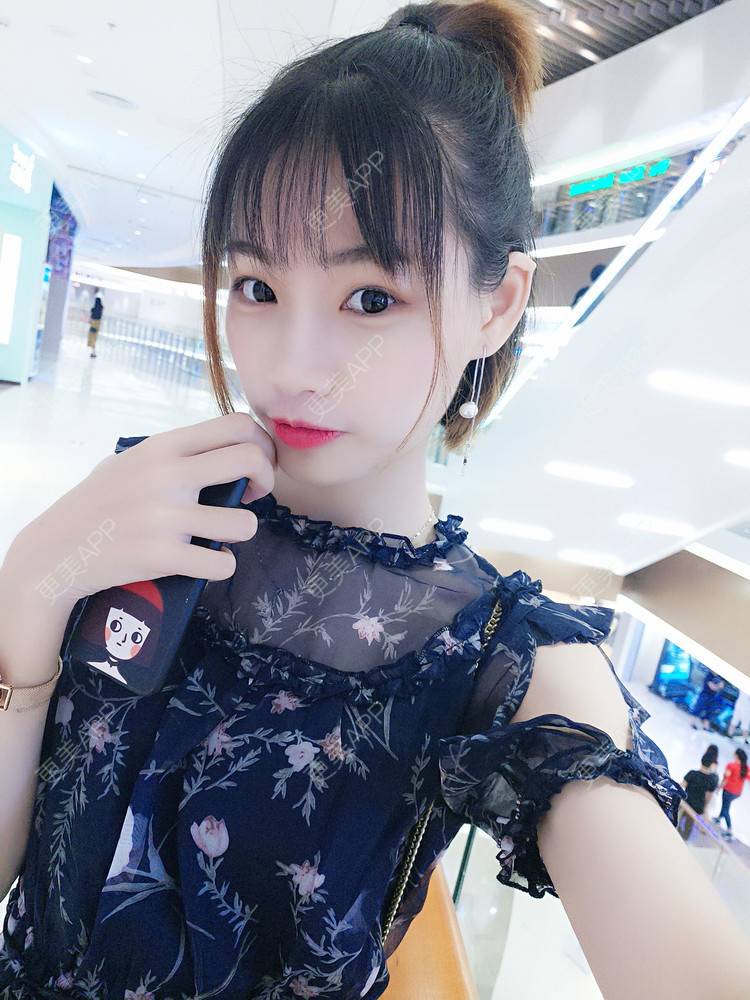 更美 - 李继华 医生的下颌角经验 | 视频日记 | 下颌角