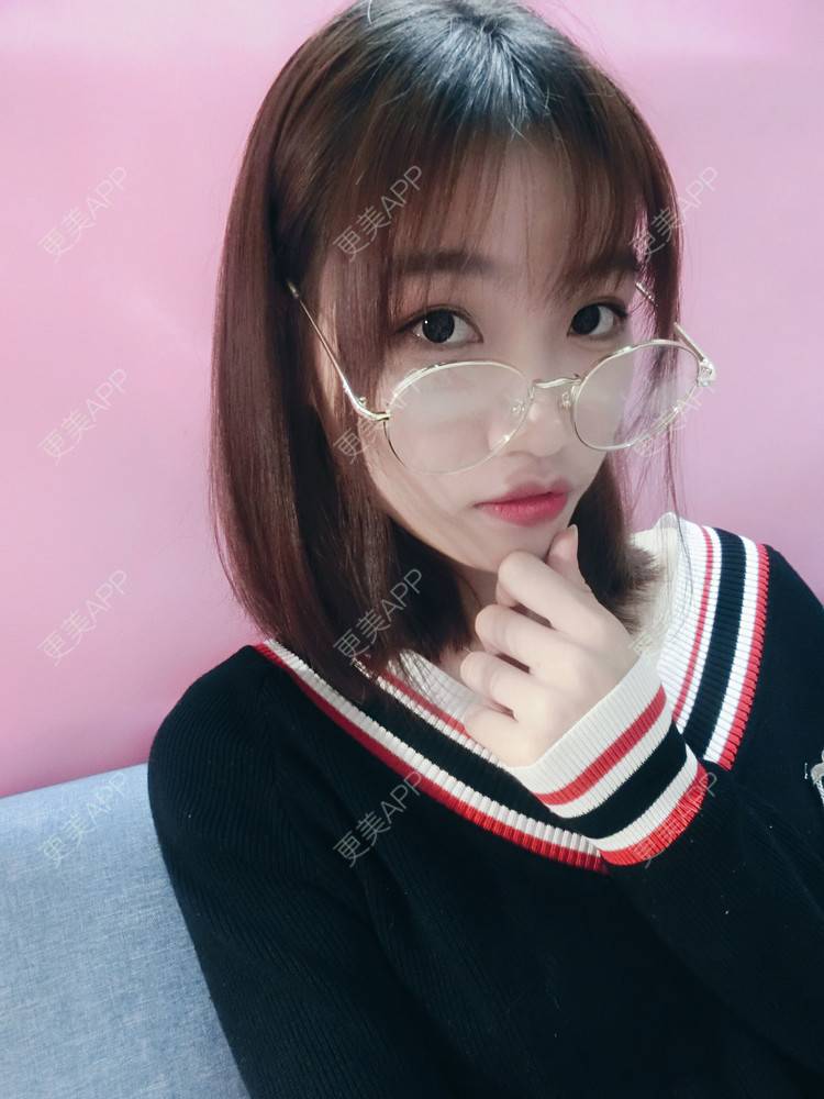 更美 - 李继华 医生的下颌角经验 | 视频日记 | 下颌角