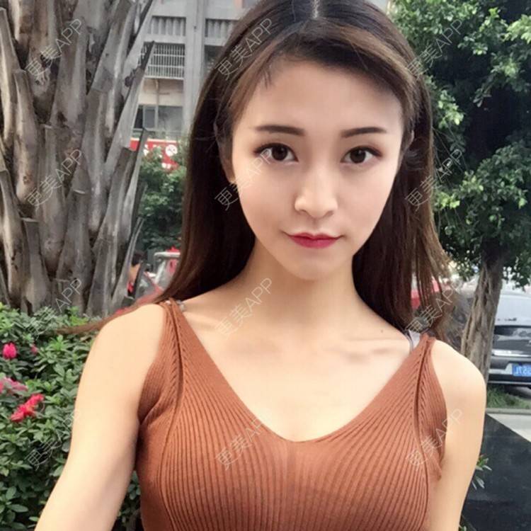 粥舟的假体隆胸日记