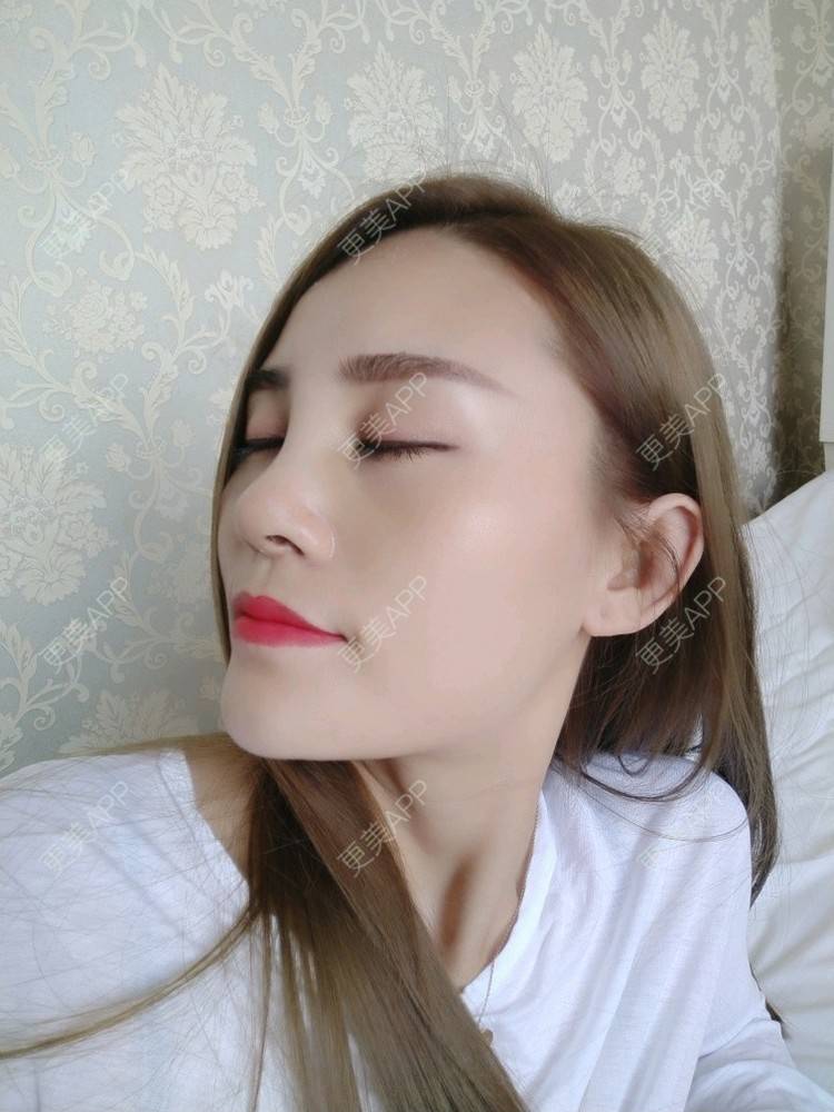 综合】鼻整形多项*耳软骨 硅胶假体隆鼻 鼻尖成型 鼻翼塑形*鼻综合