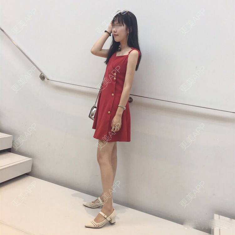 更美 - 李海兵 医生的超声溶脂经验 | 北京 | 超声溶脂