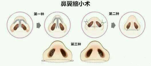 更美 - 刘晋元 医生的经验 | 太原