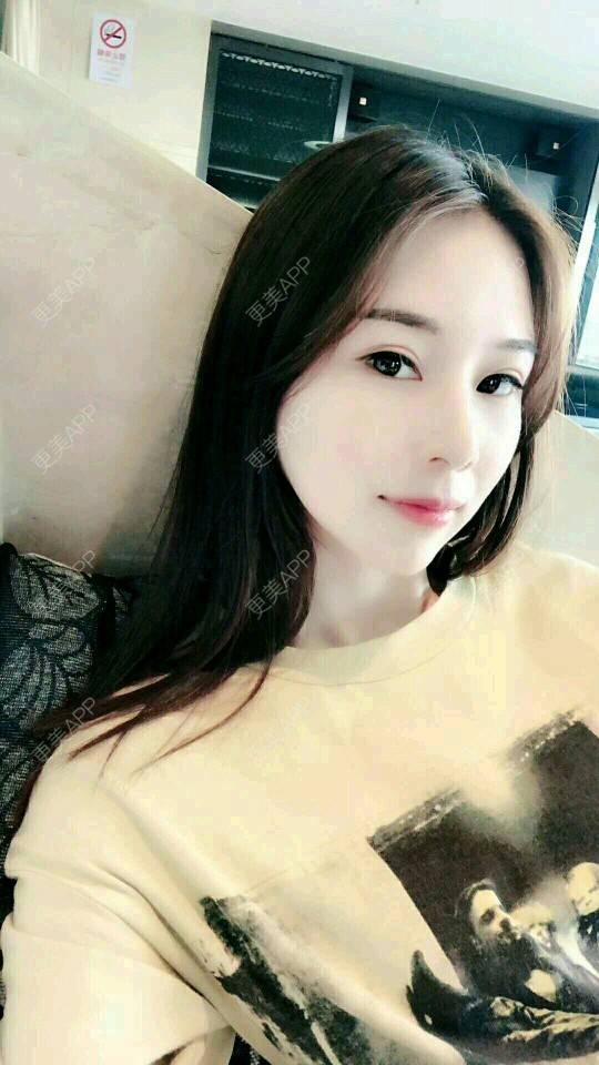 更美 - xNz3B婷的歪鼻矫正经验 | 上海 | 歪鼻矫正