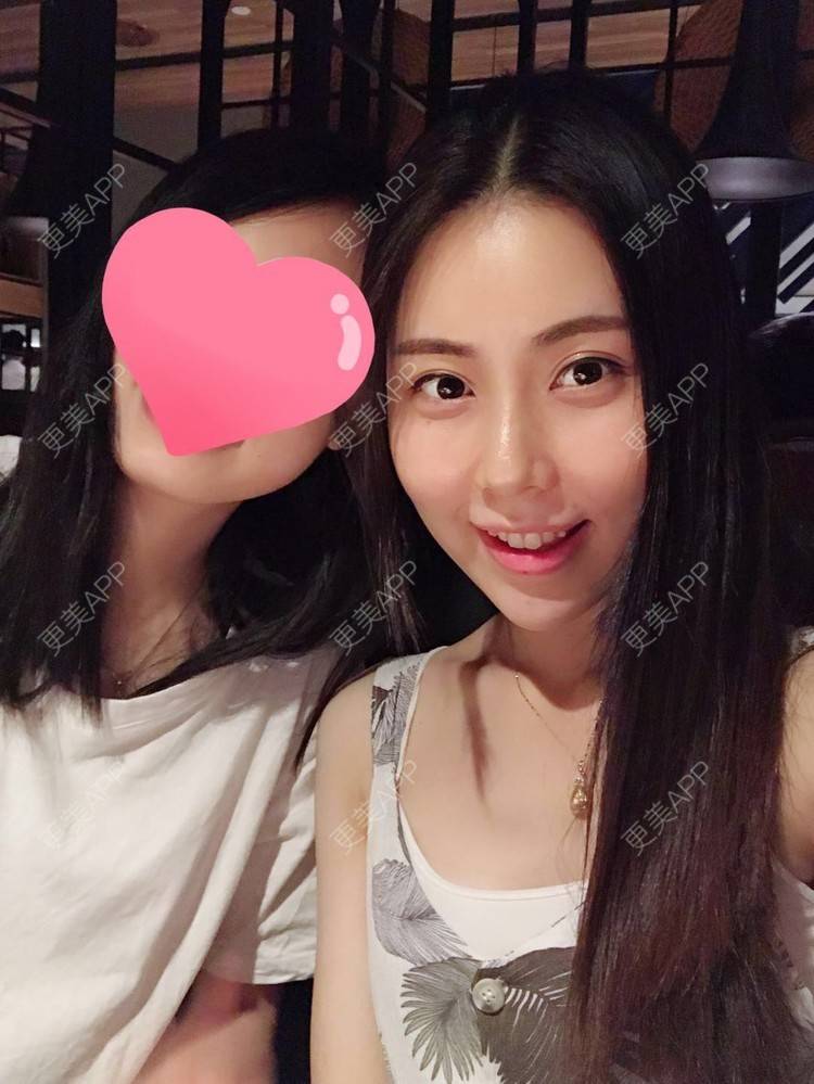 更美 - 更美用户1X3Nj1mzEe的经验 | 广州