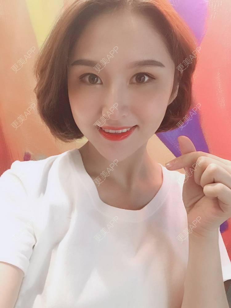 更美 - 深冬入暖的经验 | 广州 | 埋线提升