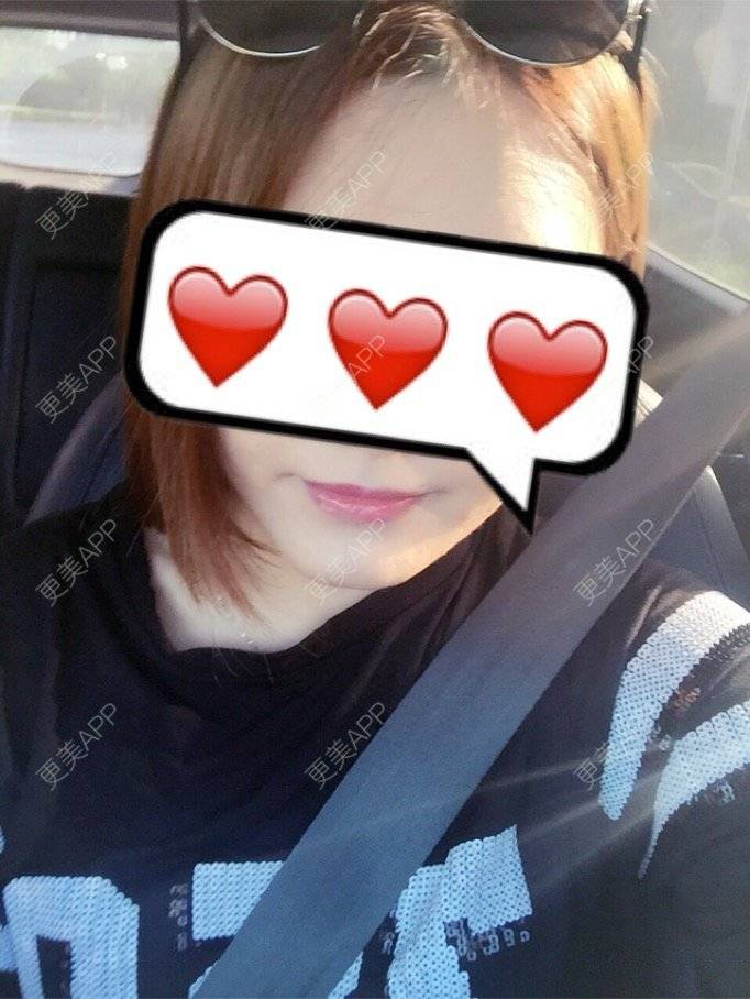 更美 - 岸边等风也等你的除皱瘦脸经验 | 成都 | 注射美肤 | 北京 | 淡化皱纹 | 水光项目 | 佛山 | 双眼皮 | 福州 | 激光脱腋毛 | 广州 | 南昌 | 嘉兴 | 深圳 | 吸脂 | 玻尿酸 | 黄金微针 | 激光脱毛 | 埋线提升 | 除皱瘦脸 | 吸脂瘦脸 | 注射美白