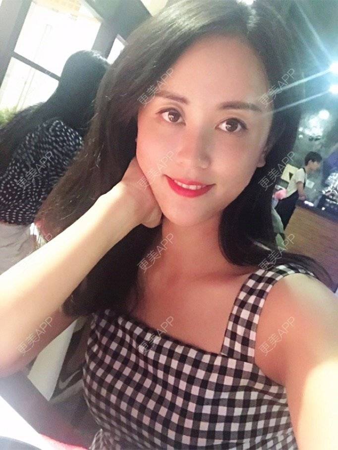 更美 - 看不开小姐的玻尿酸颈纹经验 | 玻尿酸颈纹 | 重庆