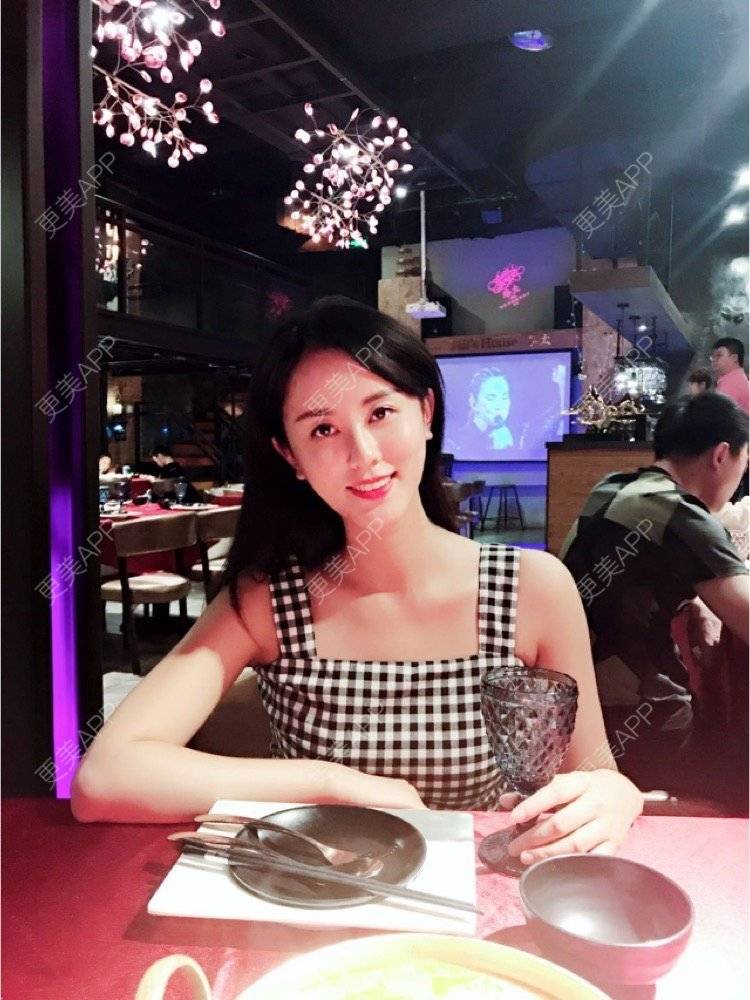 更美 - 看不开小姐的玻尿酸颈纹经验 | 玻尿酸颈纹 | 重庆