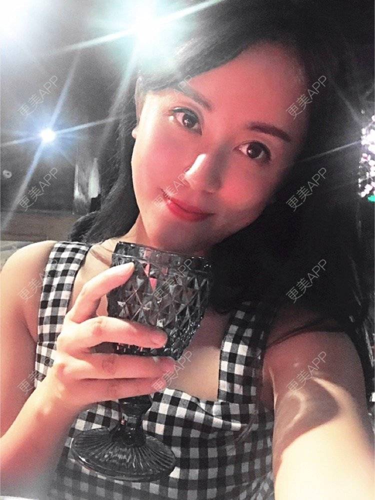 更美 - 看不开小姐的玻尿酸颈纹经验 | 玻尿酸颈纹 | 重庆