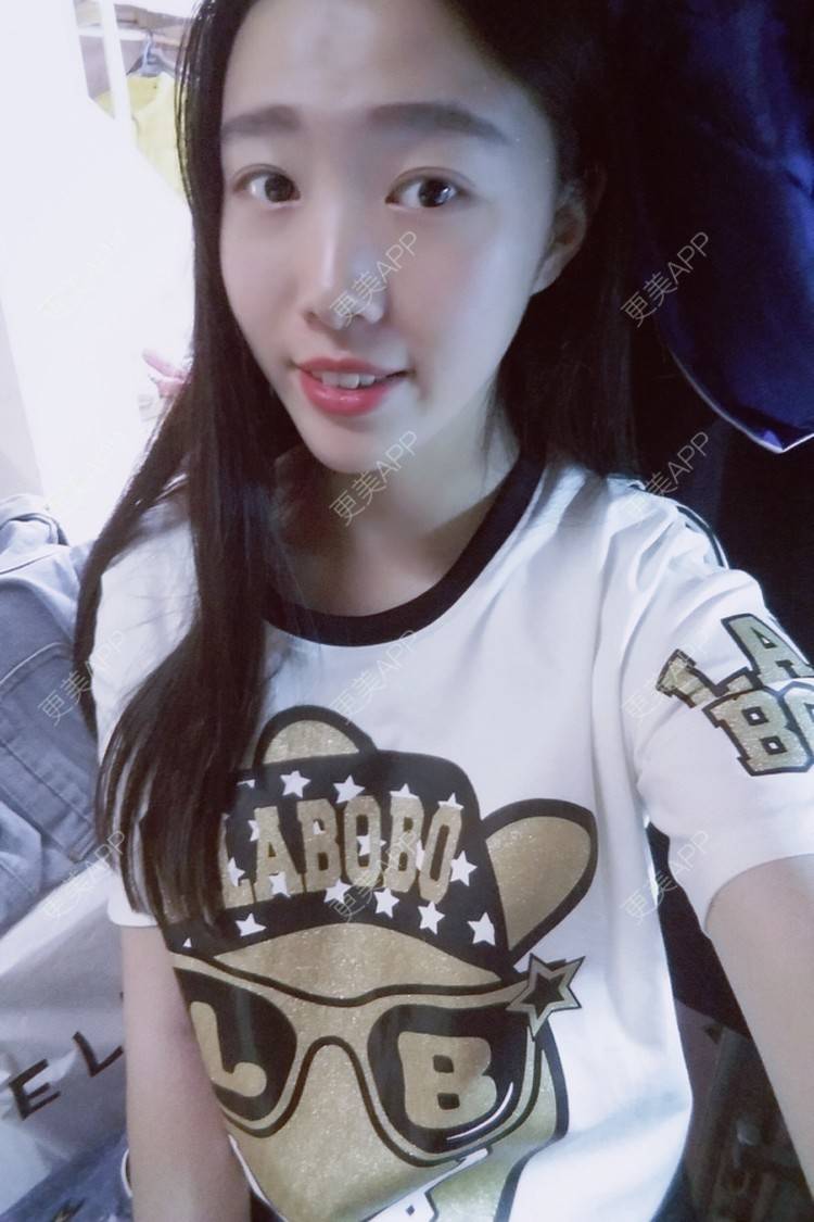 隔壁老王是哈麻批的双眼皮日记