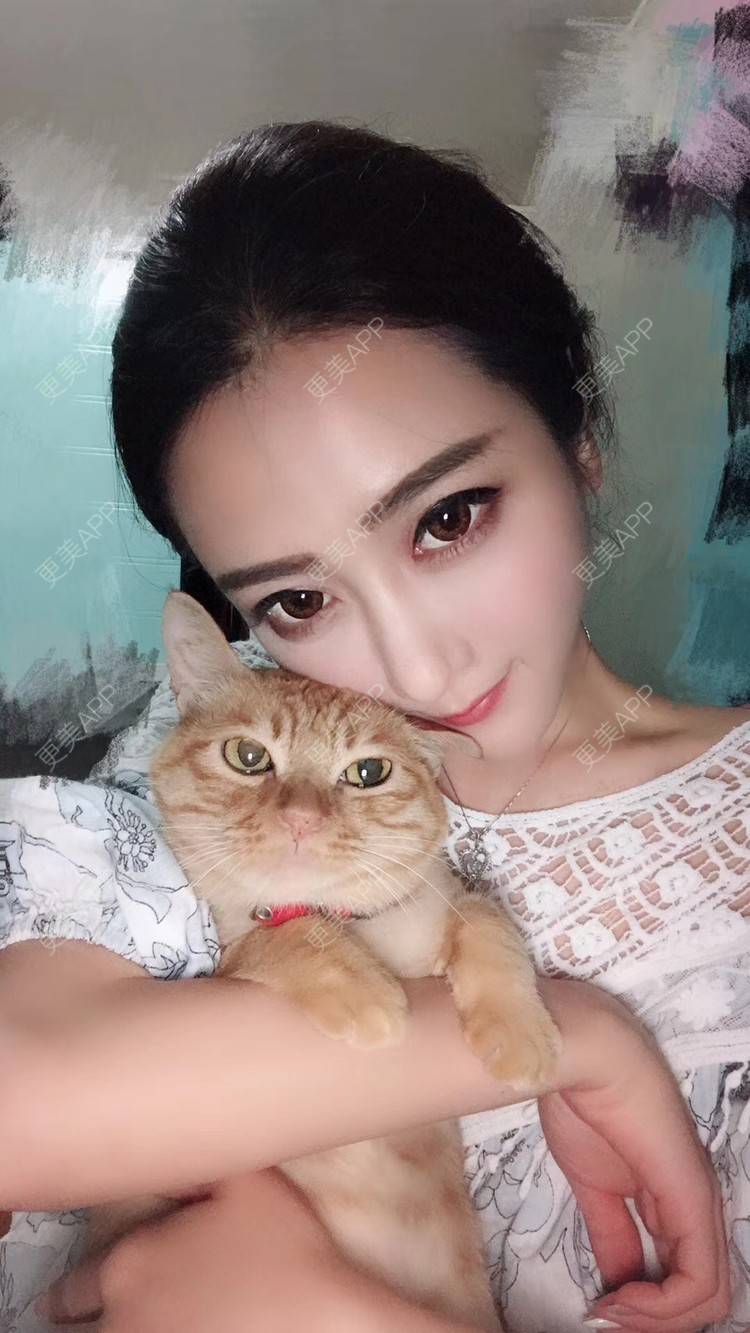 更美 - 莹莹D緈諨的鼻部多项经验 | 膨体隆鼻 | 视频日记 | 鼻部多项 | 耳软骨隆鼻 | 广州 | 驼峰鼻矫正 | 鼻形态修复