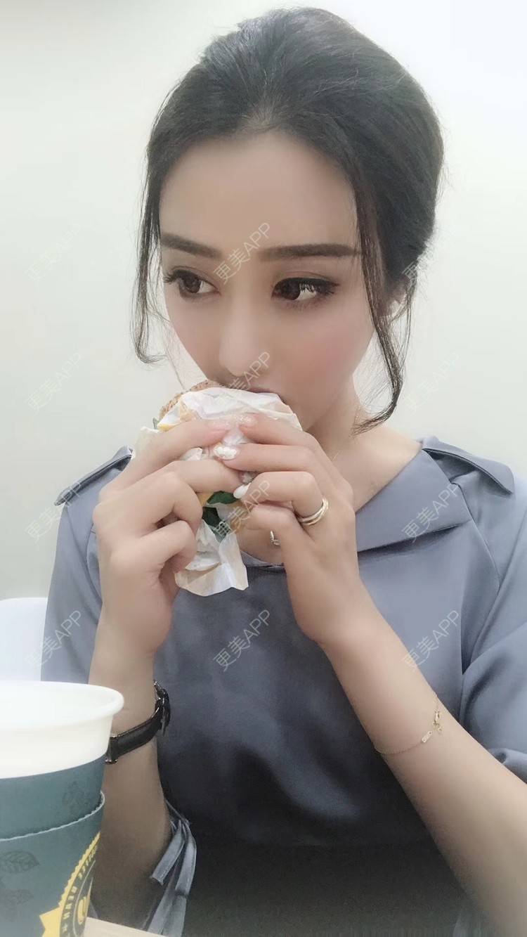 更美 - 莹莹D緈諨的鼻部多项经验 | 膨体隆鼻 | 视频日记 | 鼻部多项 | 耳软骨隆鼻 | 广州 | 驼峰鼻矫正 | 鼻形态修复