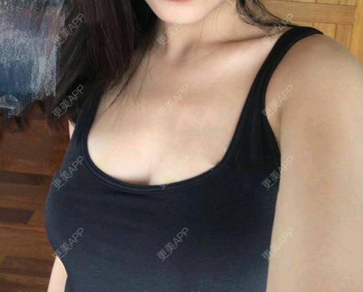 更美用户kdigic6mv1的丰胸隆胸日记