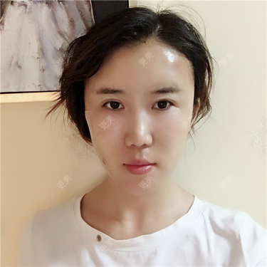 王弈婷 医生