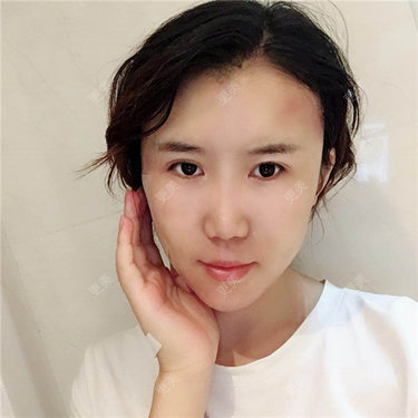 王弈婷 医生