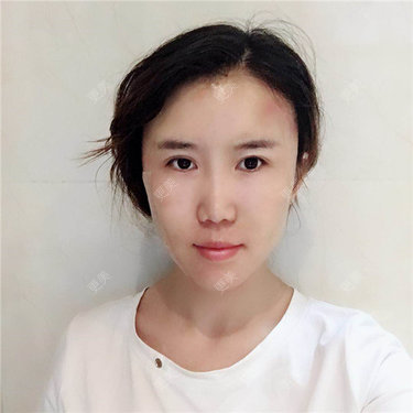 王弈婷 医生