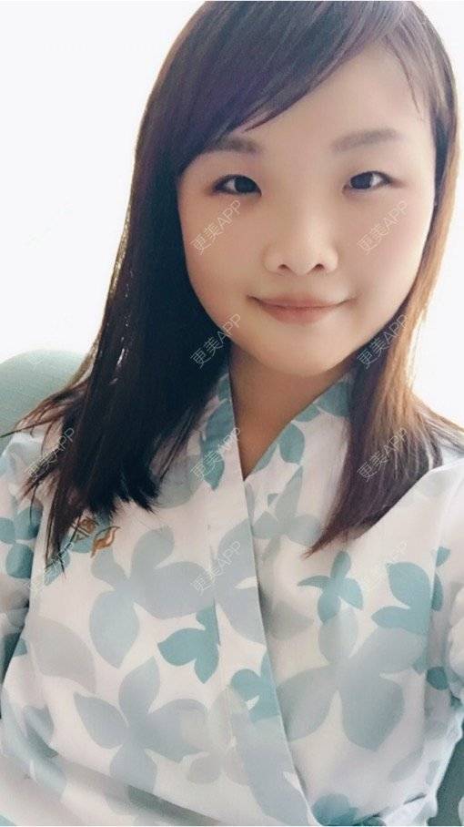 shan单的双眼皮日记